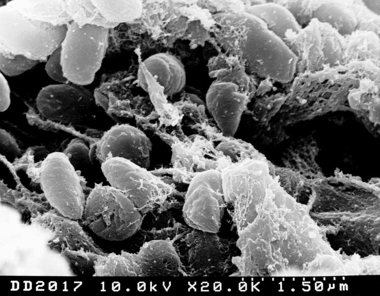 Cells of Yersinia Pestis, the bacteria that causes plague, as seen with an electron microscope.