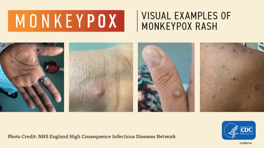 Monkeypox claims -Efficacy Testing